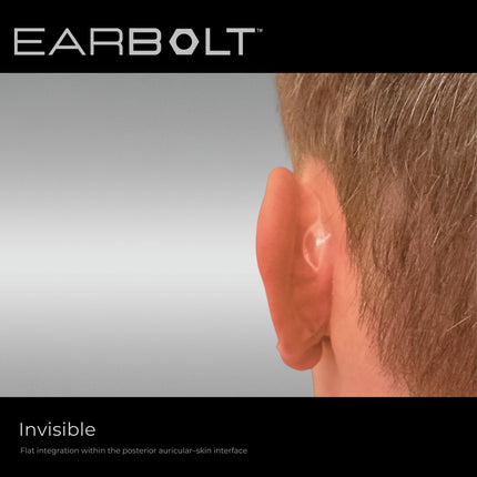 EARBOLT Ear-Pinning Adhesives | Otoplasty Alternative