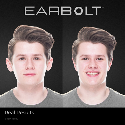 EARBOLT Ear-Pinning Adhesives | Otoplasty Alternative